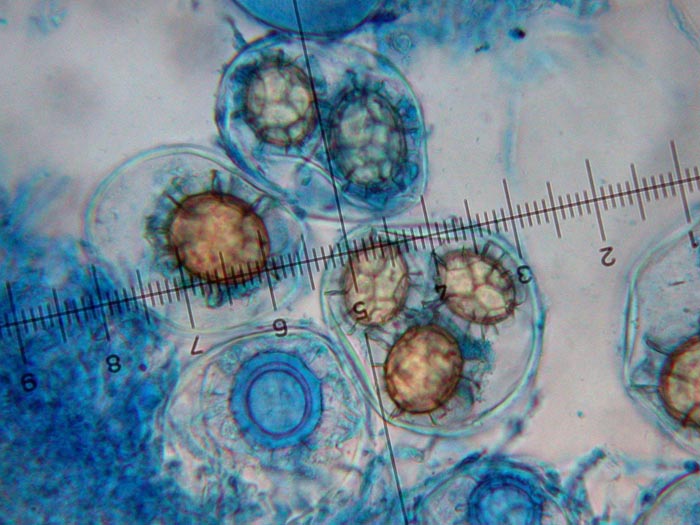 macrostoma
