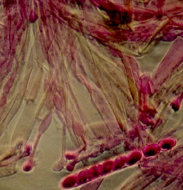 macrostoma