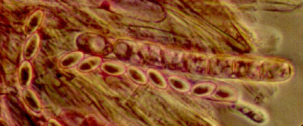 macrostoma
