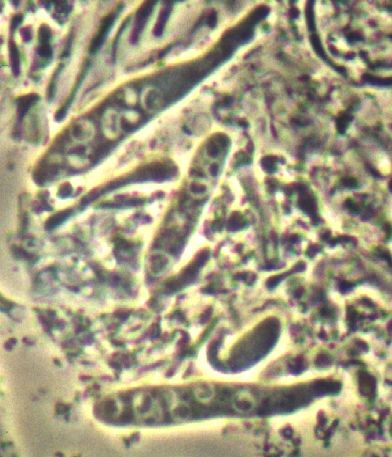 macrostoma
