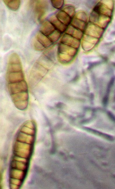 macrostoma
