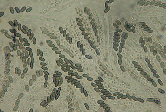 macrostoma