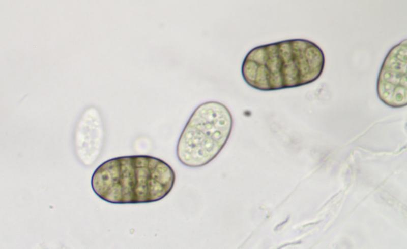 macrostoma