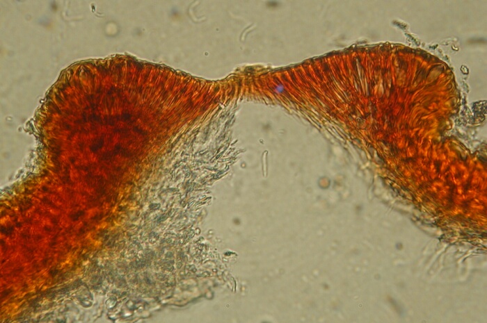 macrostoma