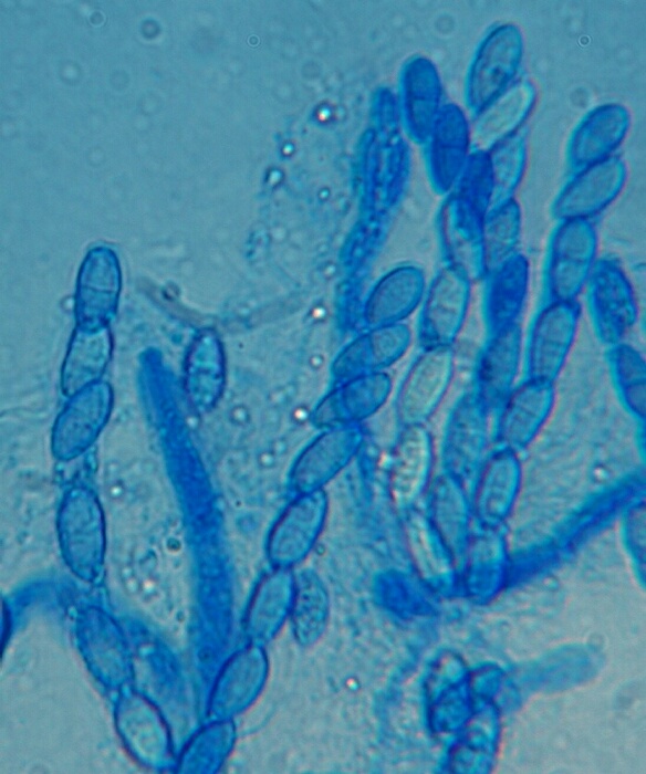 macrostoma