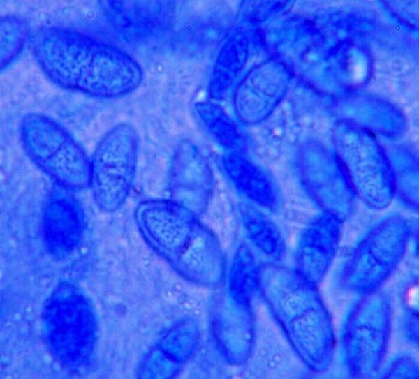 macrostoma