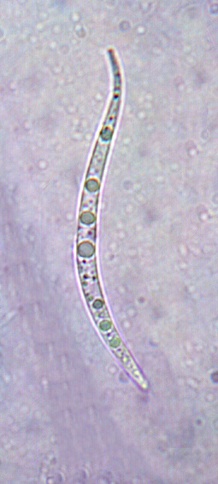 macrostoma