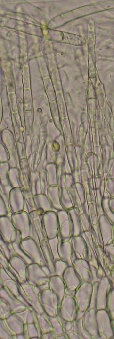macrostoma