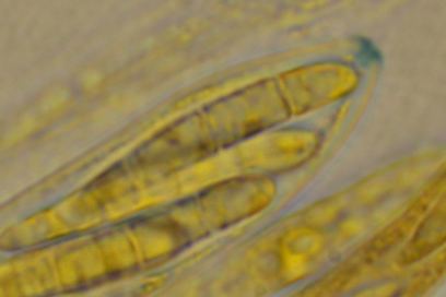 macrostoma