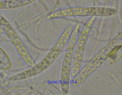 macrostoma