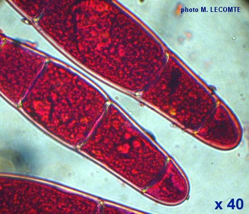 macrostoma