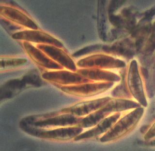 macrostoma