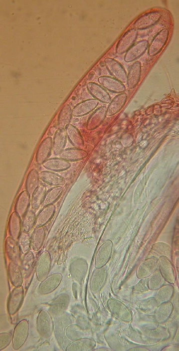 macrostoma