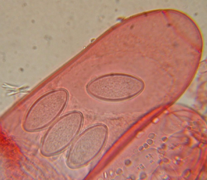 macrostoma
