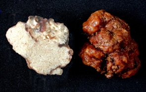 macrostoma