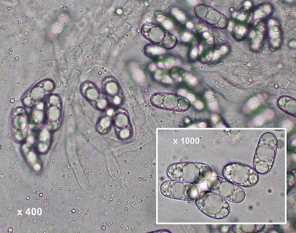 macrostoma