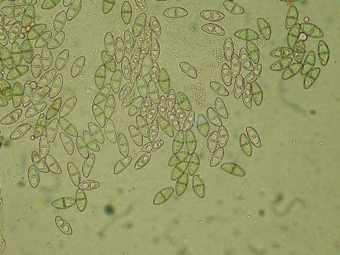 macrostoma