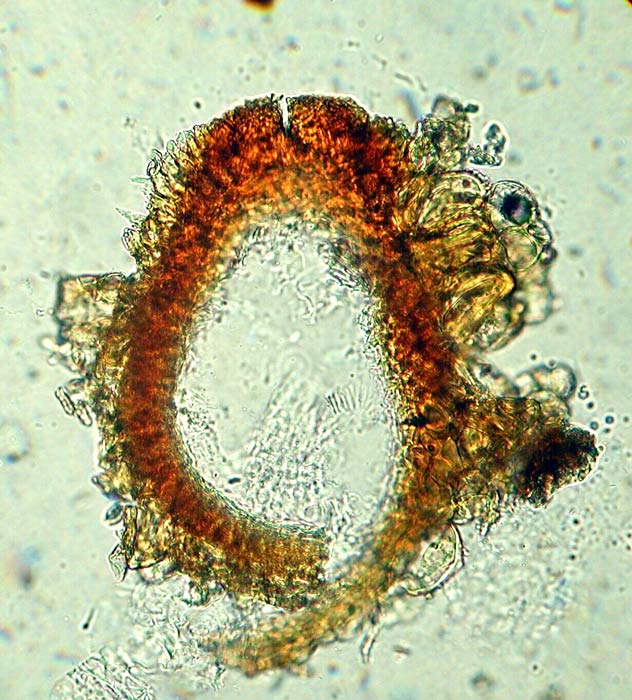 macrostoma