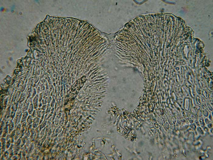 macrostoma