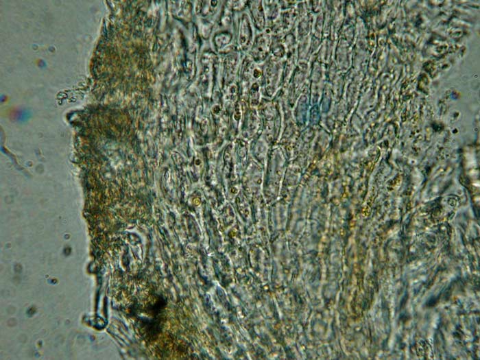 macrostoma