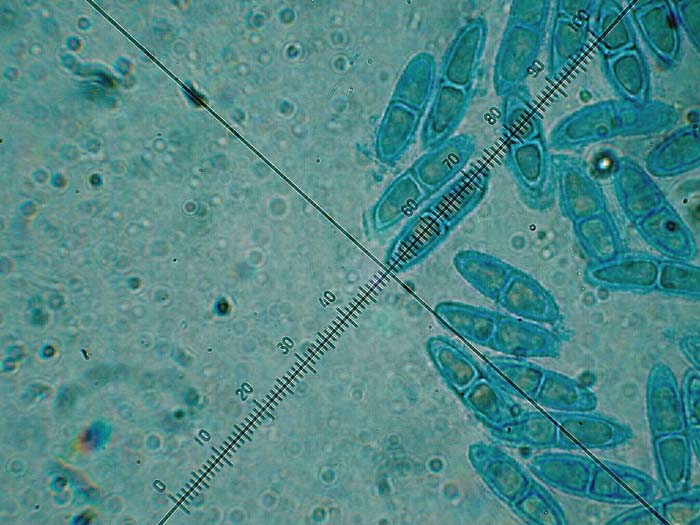 macrostoma