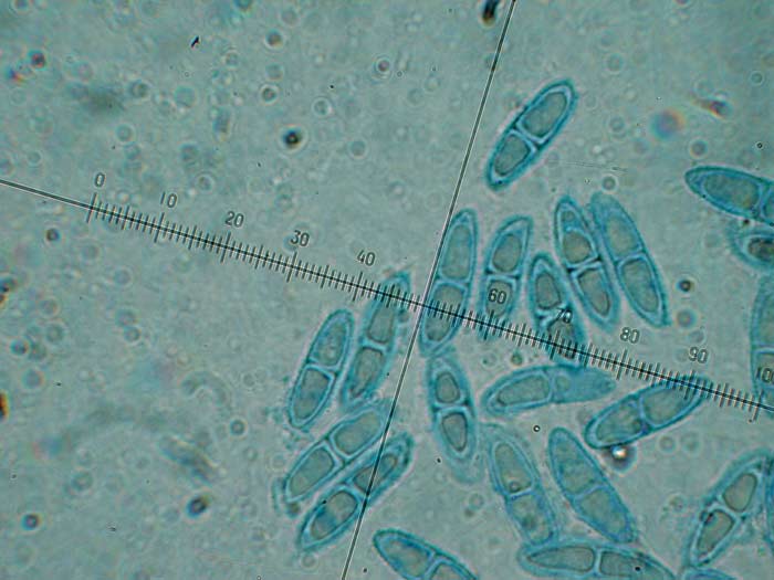 macrostoma