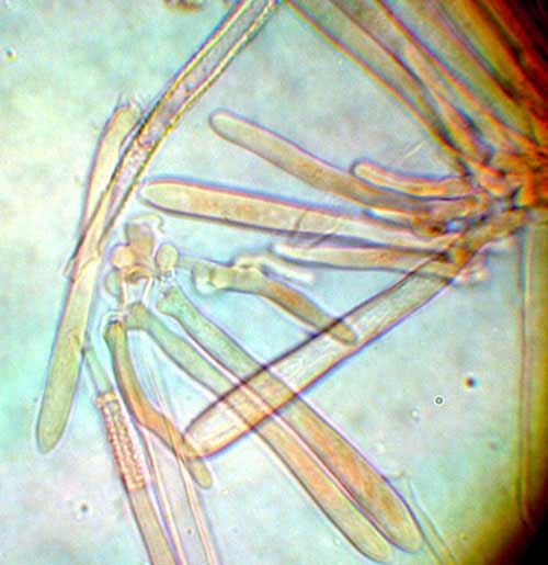 macrostoma