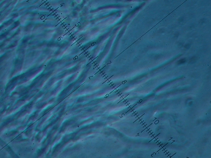 macrostoma