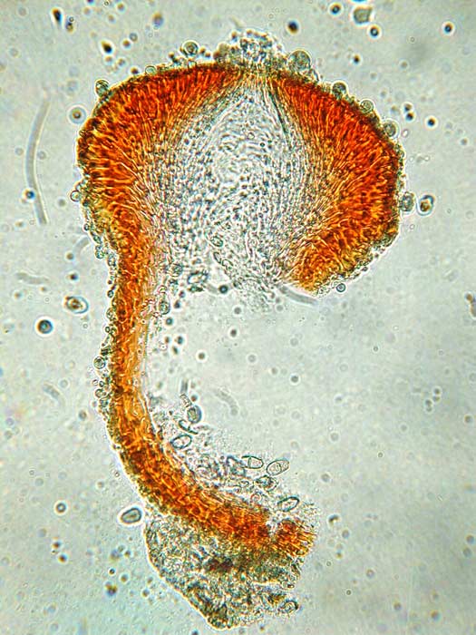 macrostoma