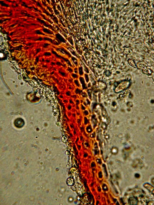 macrostoma