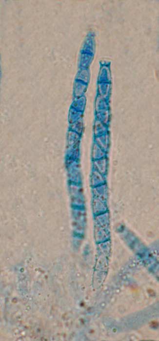 macrostoma
