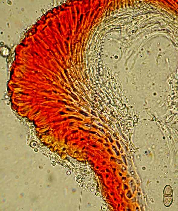 macrostoma