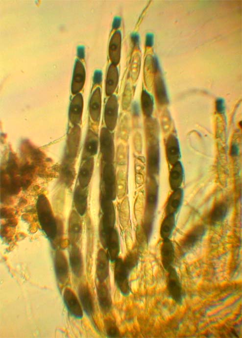 macrostoma