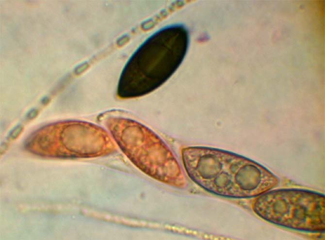 macrostoma