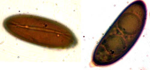 macrostoma