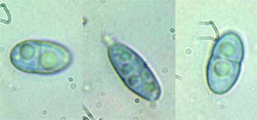 macrostoma