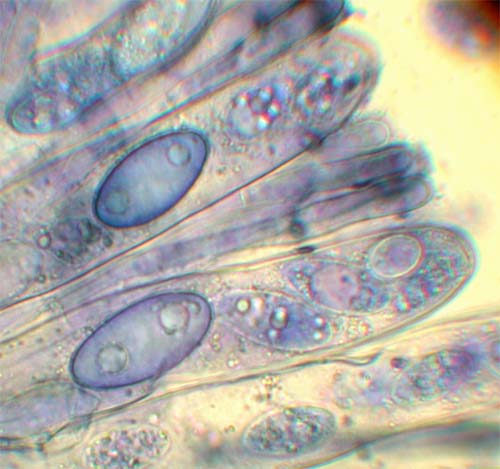 macrostoma