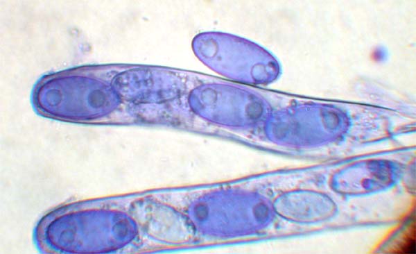 macrostoma