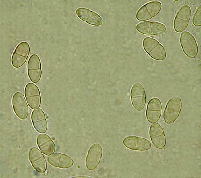 macrostoma