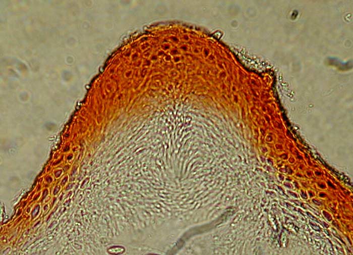 macrostoma