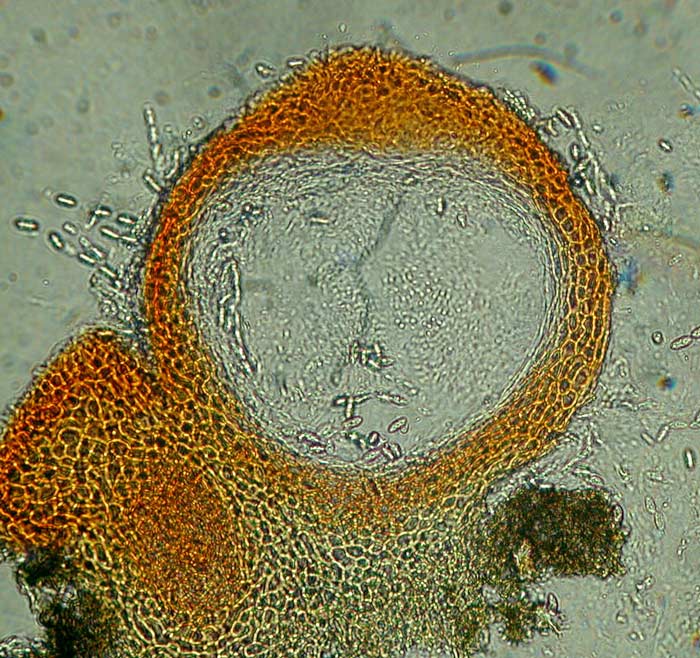 macrostoma