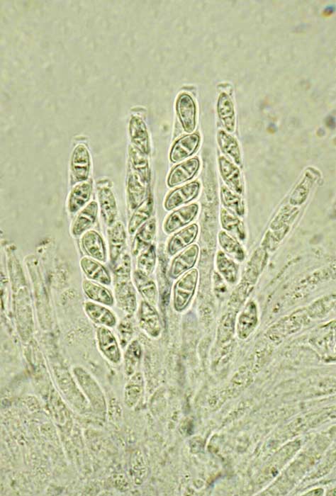 macrostoma