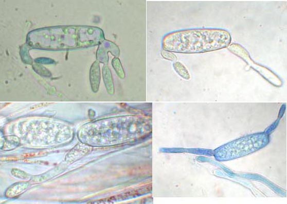 macrostoma