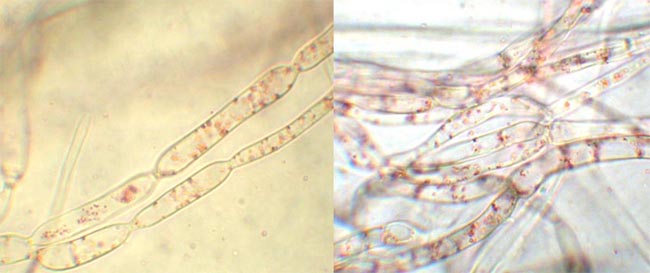 macrostoma