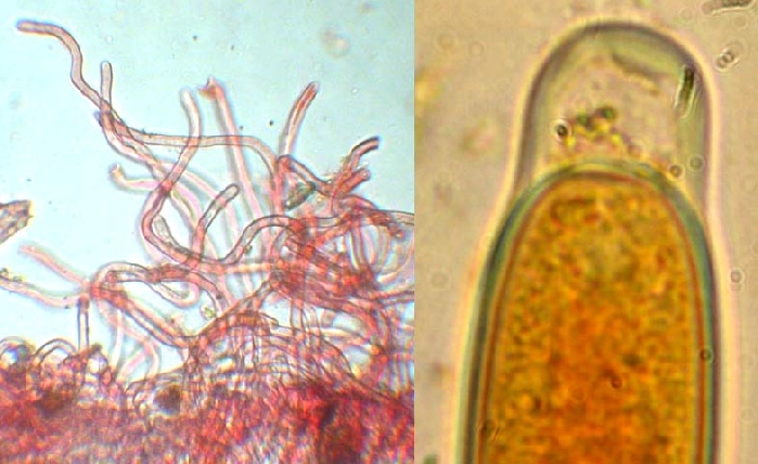macrostoma