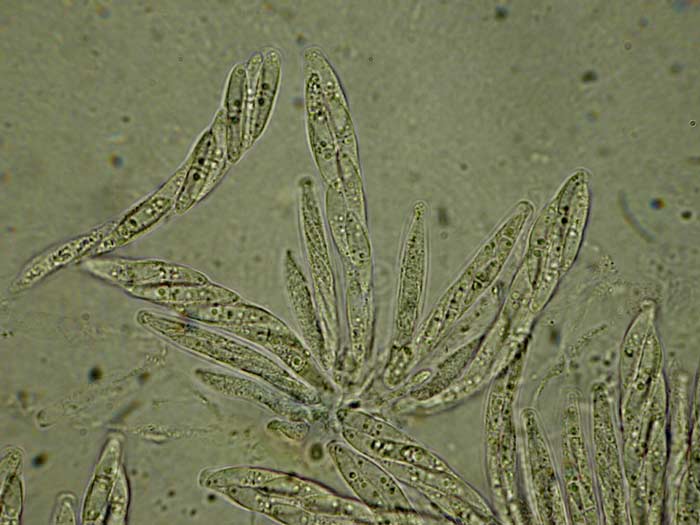 macrostoma