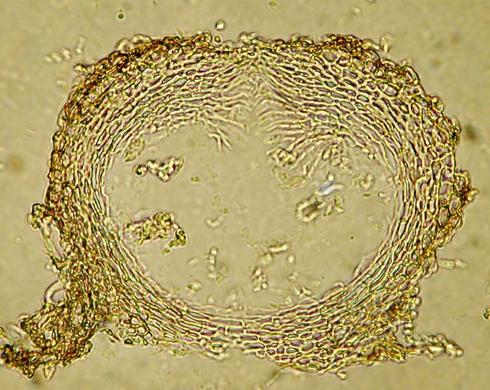 macrostoma