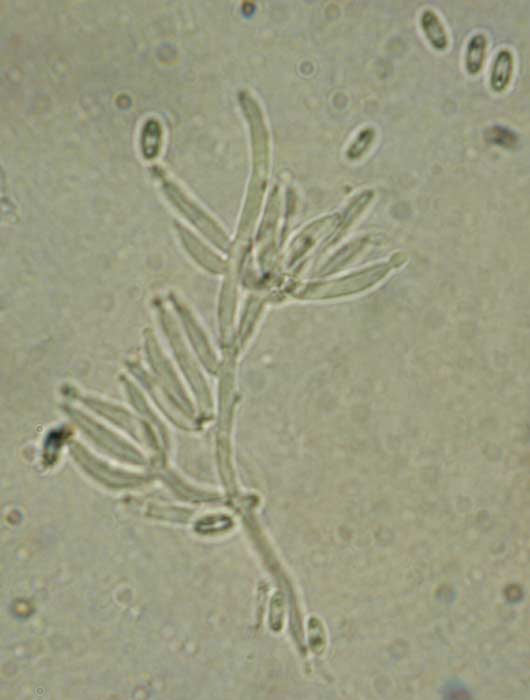 macrostoma
