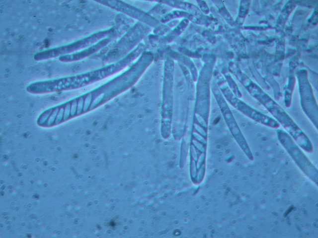macrostoma