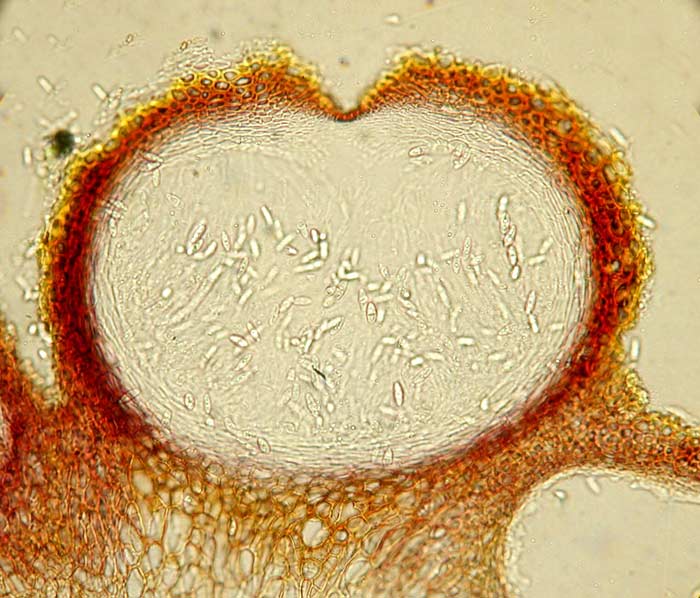 macrostoma